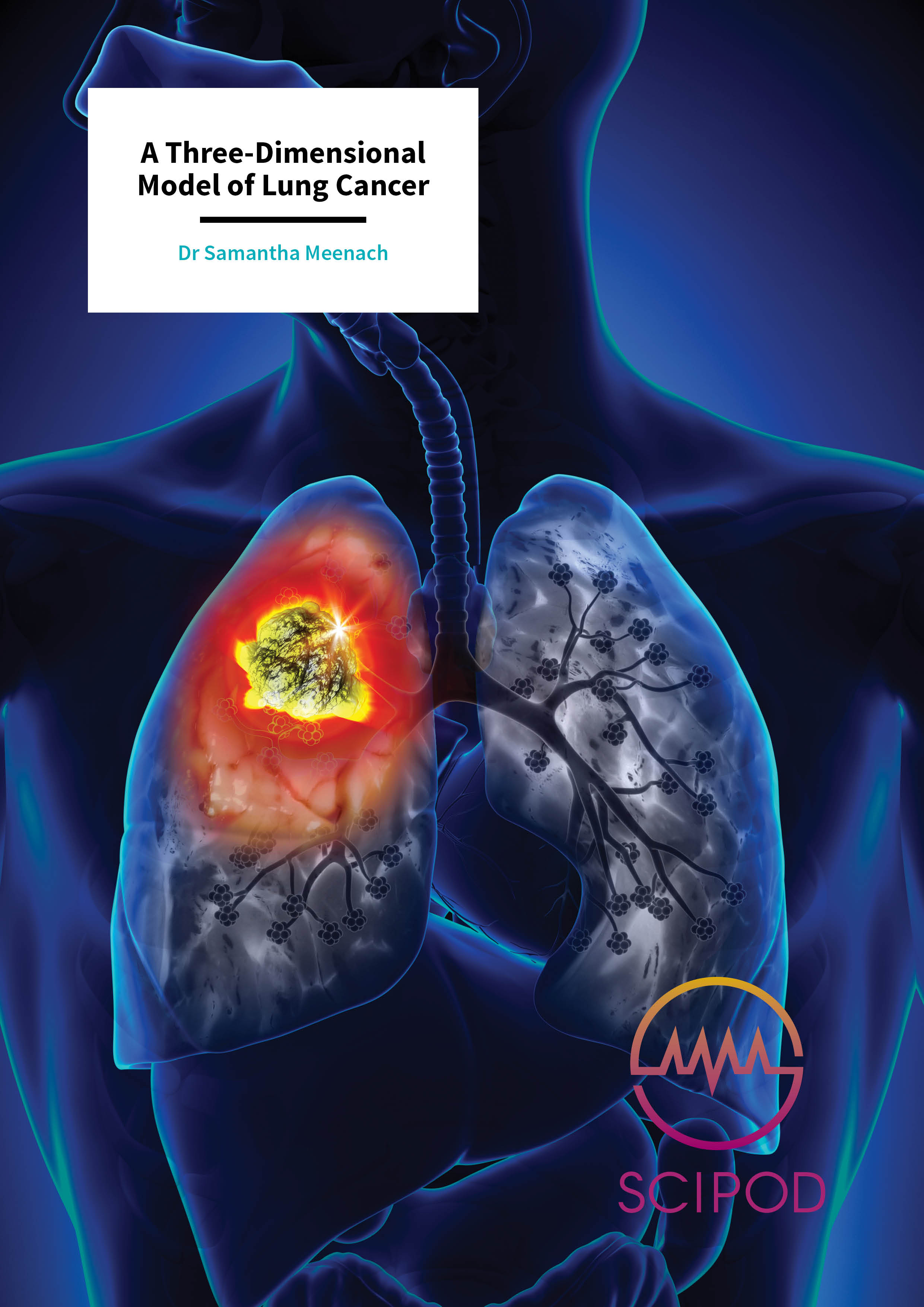 A Three-Dimensional Model of Lung Cancer – Dr Samantha Meenach, University of Rhode Island