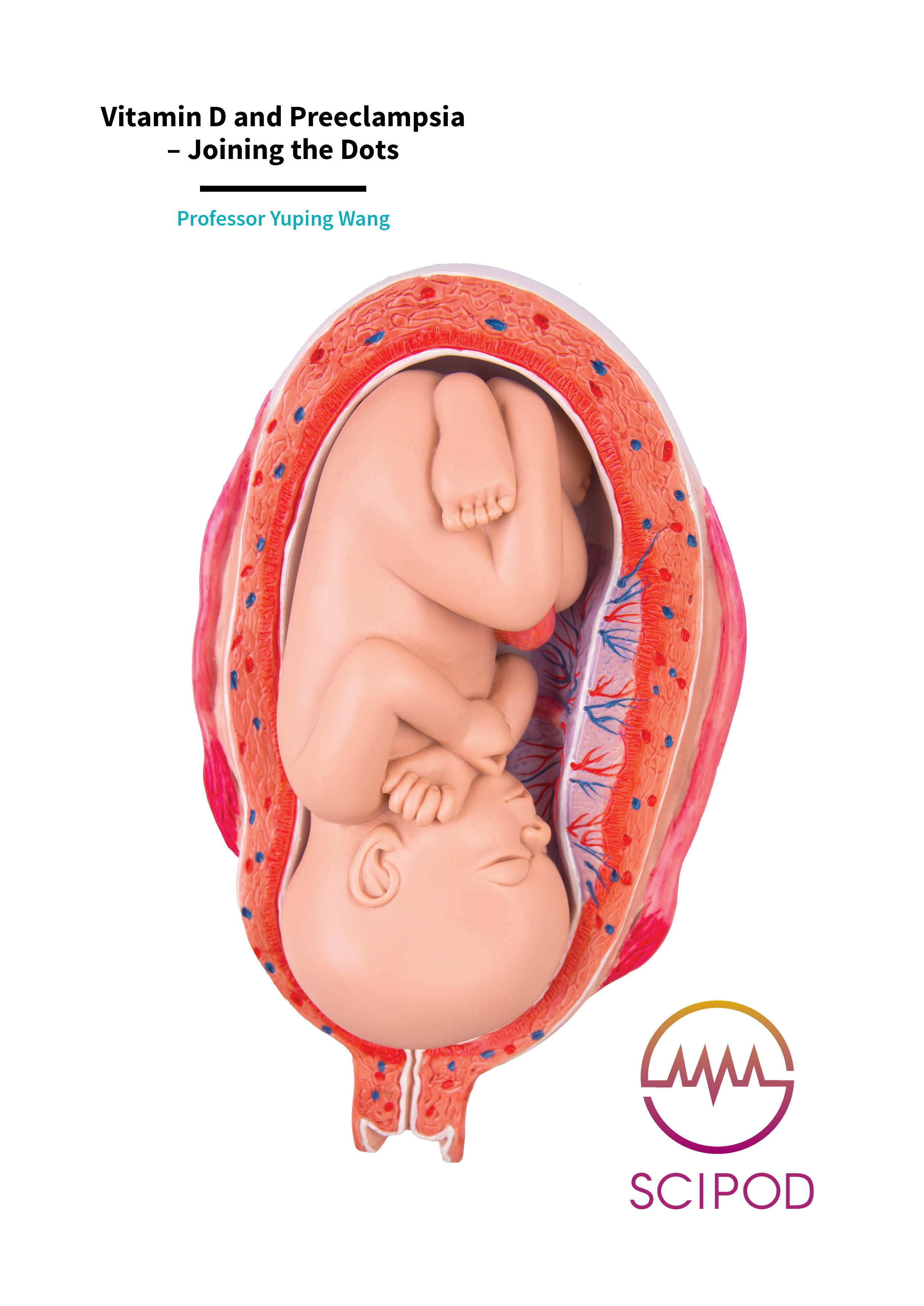 Vitamin D and Preeclampsia, Joining the Dots – Professor Yuping Wang, Louisiana State University Health Sciences Centre