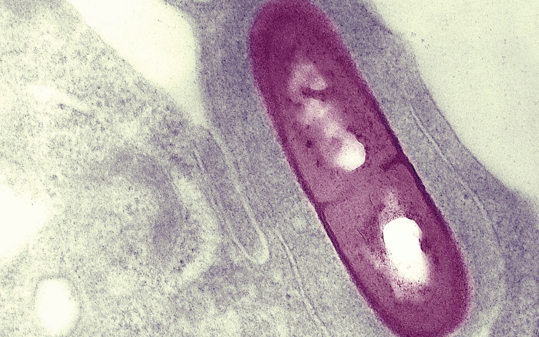 Understanding the Pathogenic Mechanisms of Intracellular Bacteria – Dr Darren Higgins, Harvard Medical School