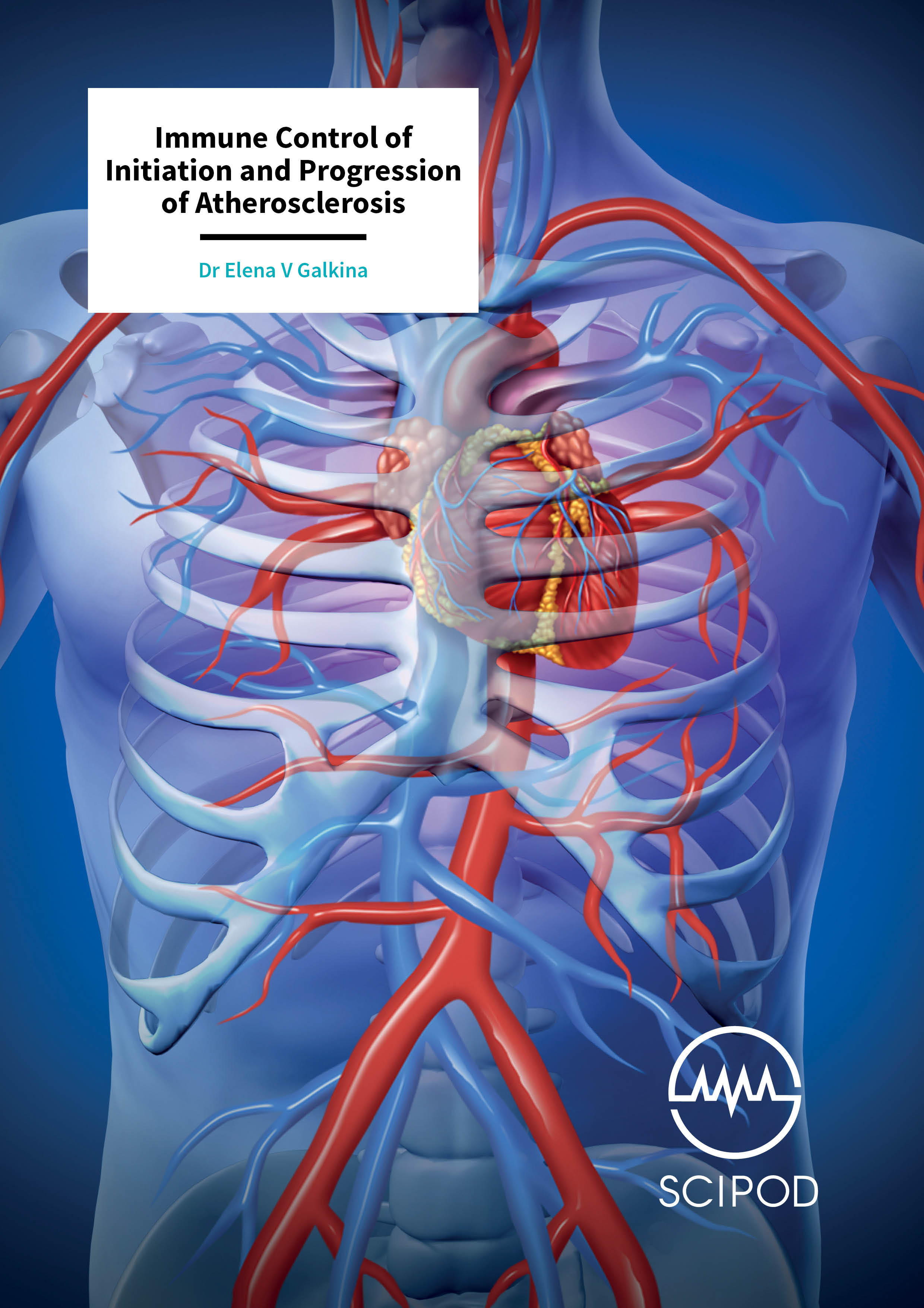 Immune Control of Initiation and Progression of Atherosclerosis – Dr Elena V Galkina, Eastern Virginia Medical School