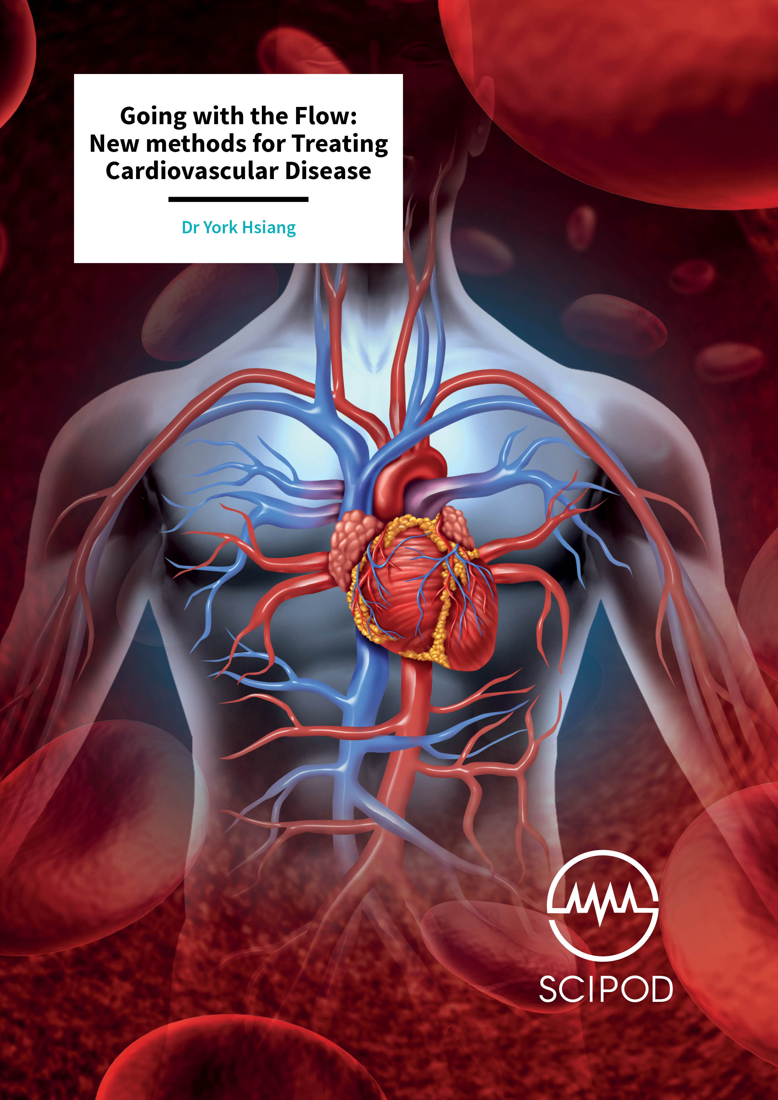 Going with the Flow: New methods for Treating Cardiovascular Disease – Dr York Hsiang, University of British Columbia Vancouver