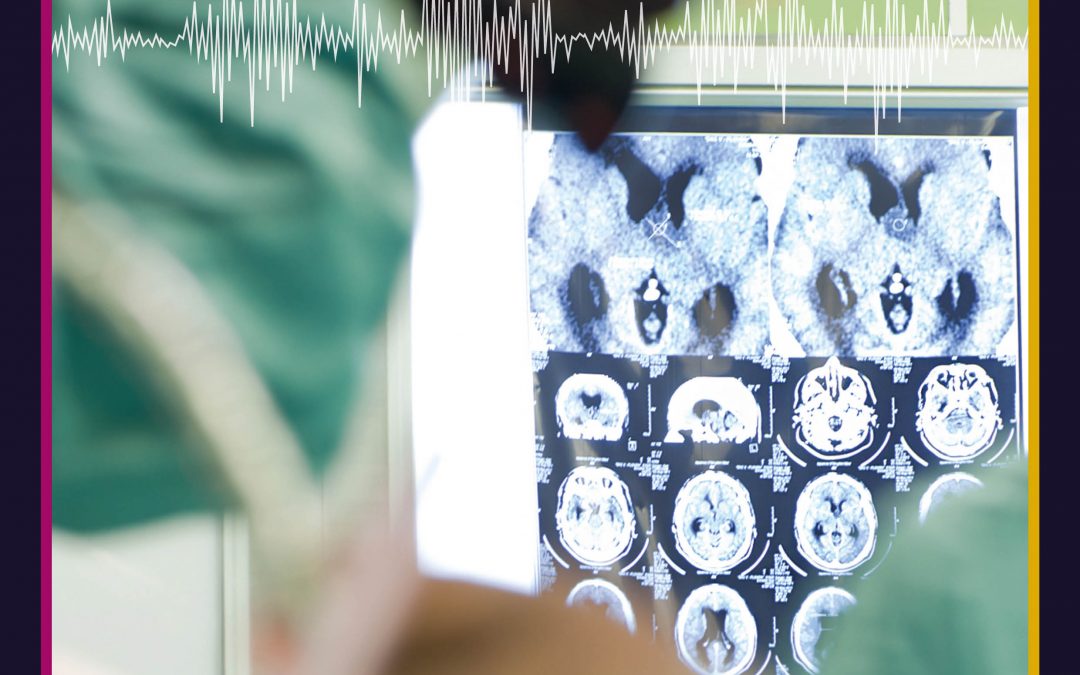 Innovations in Functional Brain Imaging to Improve Neurosurgery – Dr Jun Hua, Johns Hopkins University