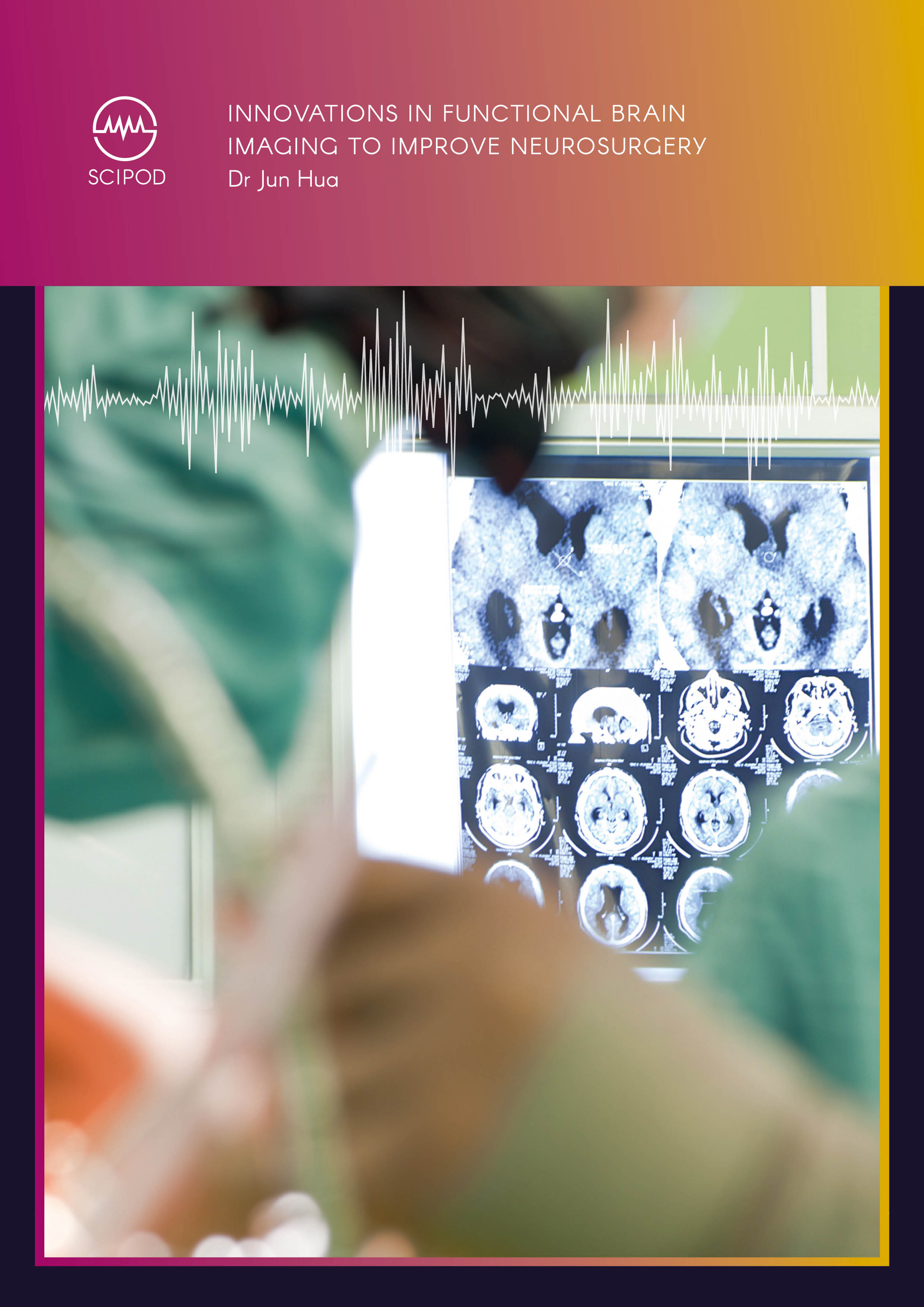 Innovations in Functional Brain Imaging to Improve Neurosurgery – Dr Jun Hua, Johns Hopkins University