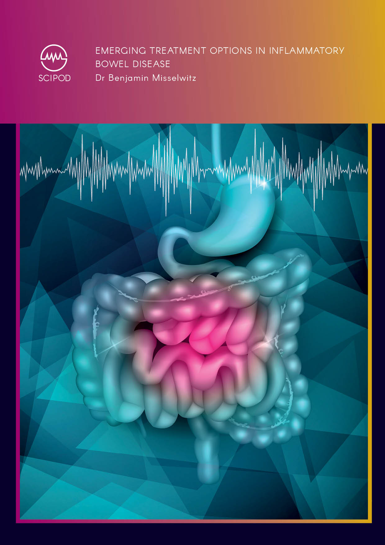 Emerging Treatment Options in Inflammatory Bowel Disease