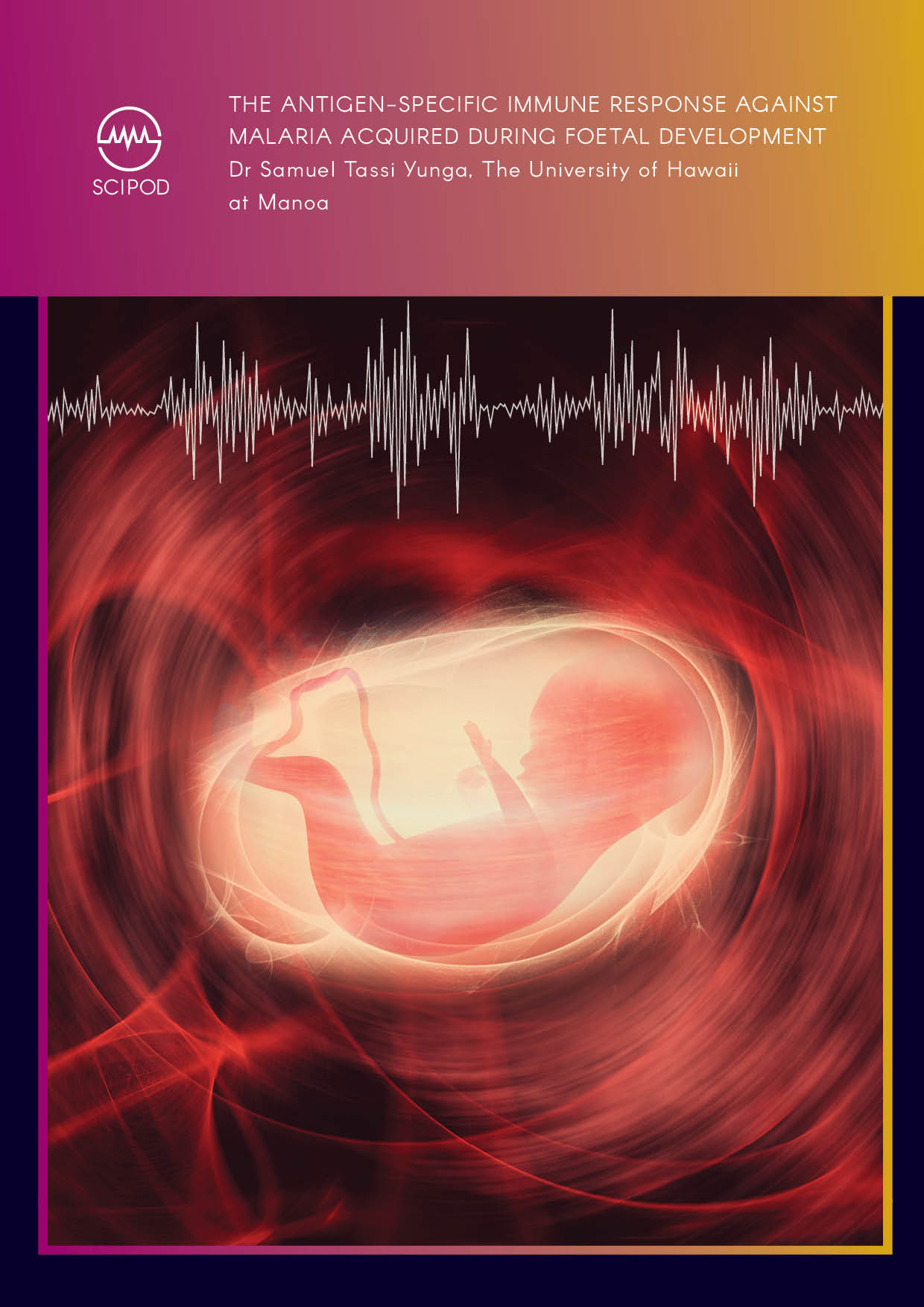 The Antigen-specific Immune Response Against Malaria Acquired During Foetal Development – Dr Samuel Tassi Yunga, University of Hawaii at Manoa