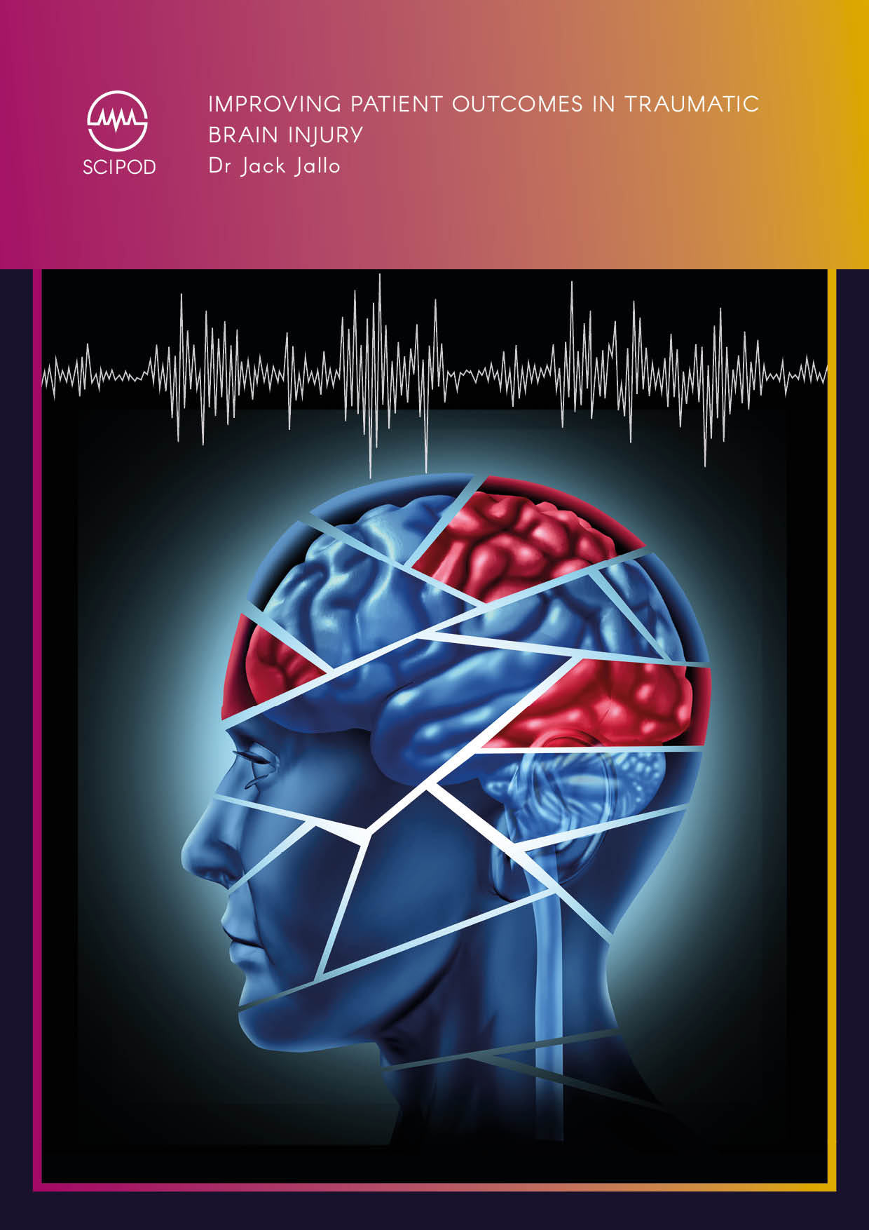 Improving Patient Outcomes In Traumatic Brain Injury – Dr Jack Jallo, Thomas Jefferson University