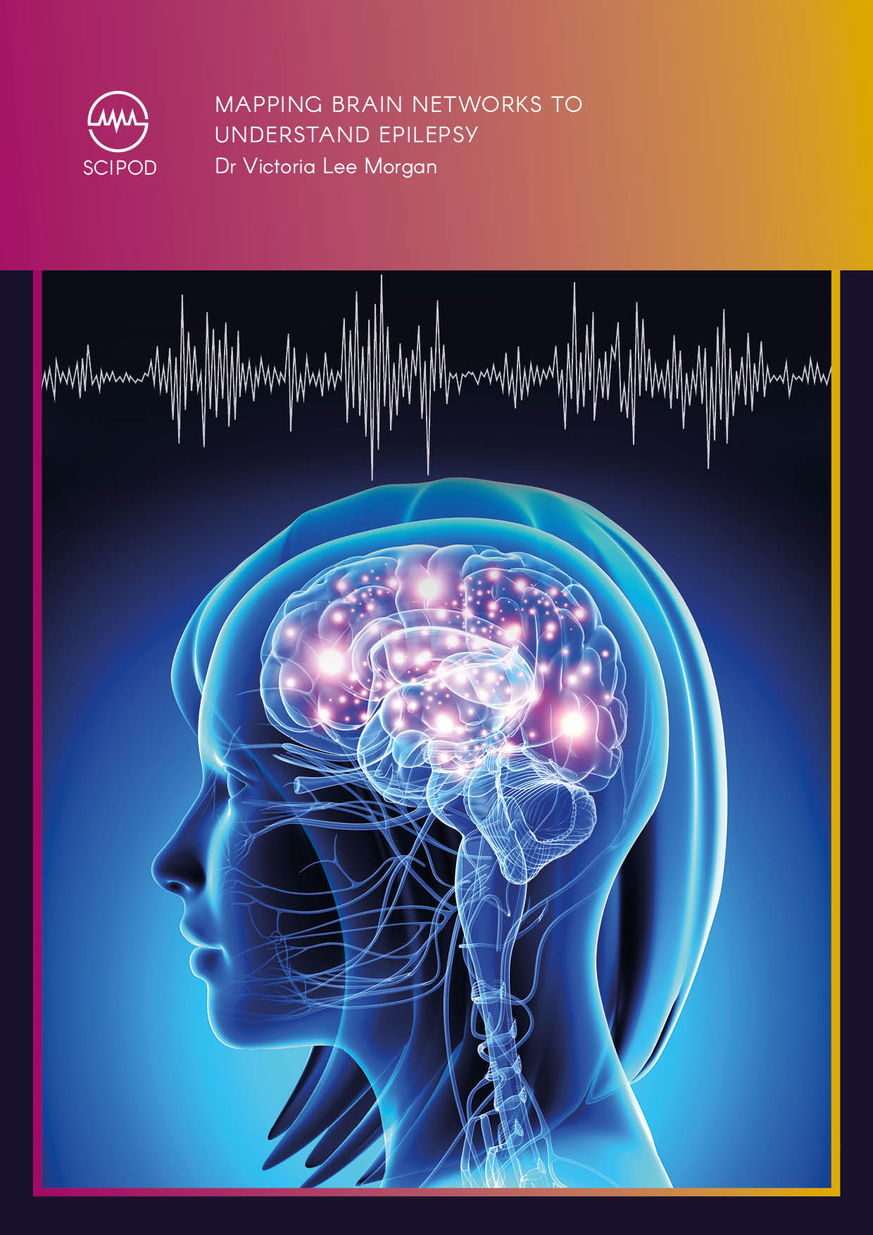 Mapping Brain Networks To Understand Epilepsy – Dr Victoria Morgan, Vanderbilt University Medical Center