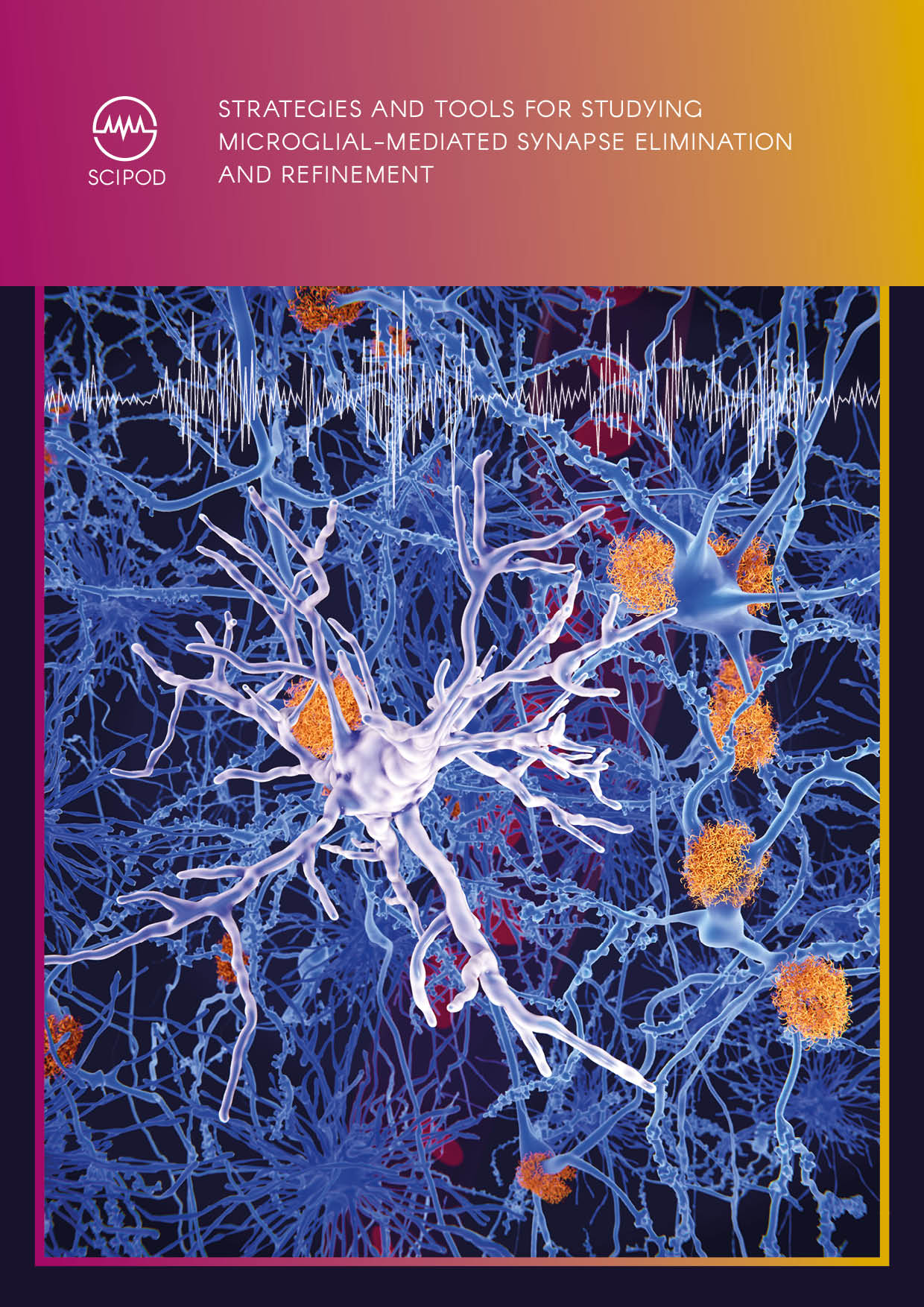 Strategies and Tools for Studying Microglial-Mediated Synapse Elimination and Refinement