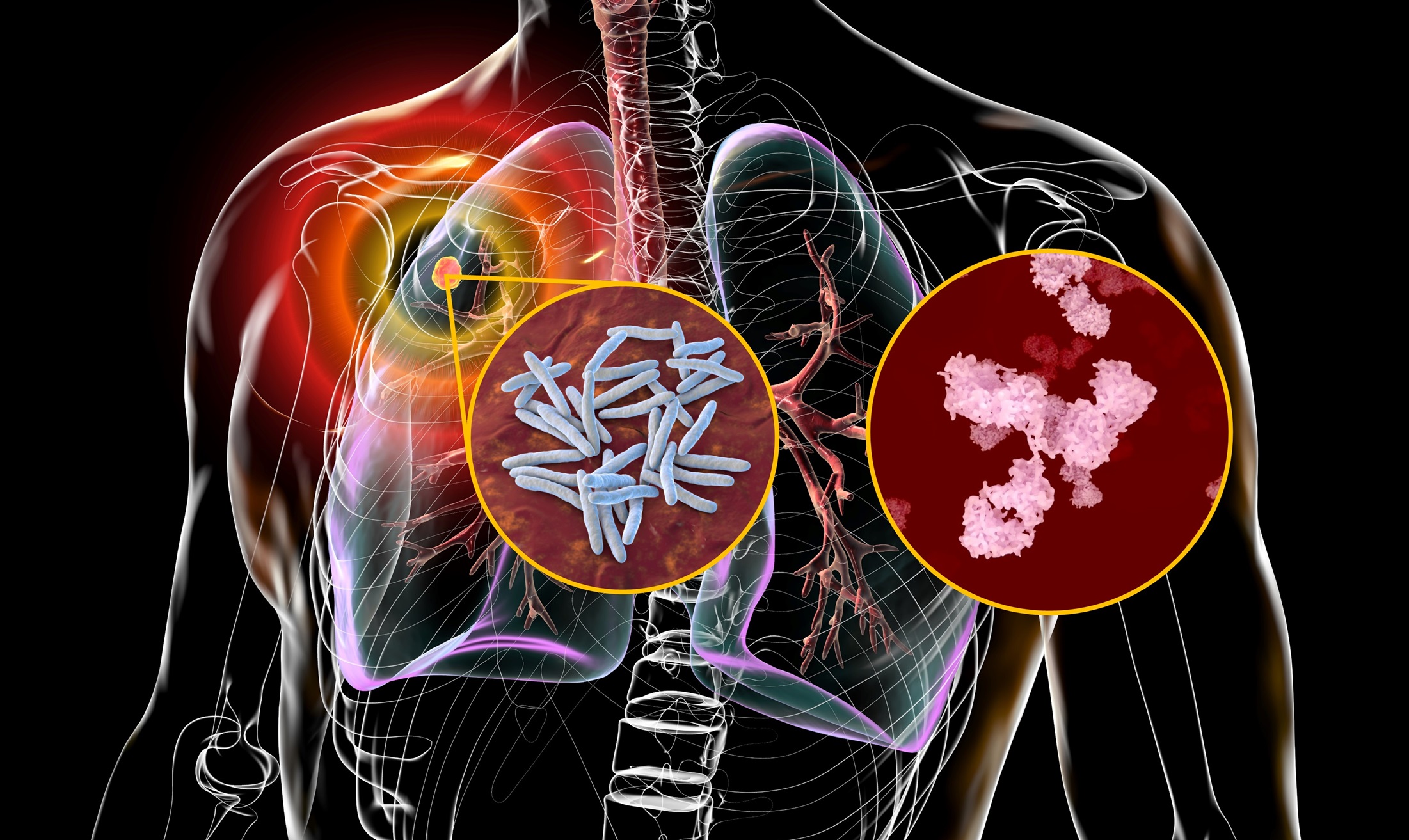 Professor Lobelia Samavati Paving The Way For Antibody based 