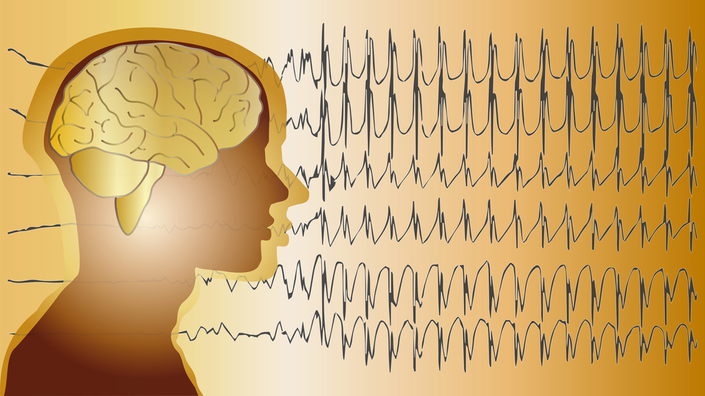 Dr Katty Kang | Deciphering the Molecular Origins of Brain Disorders
