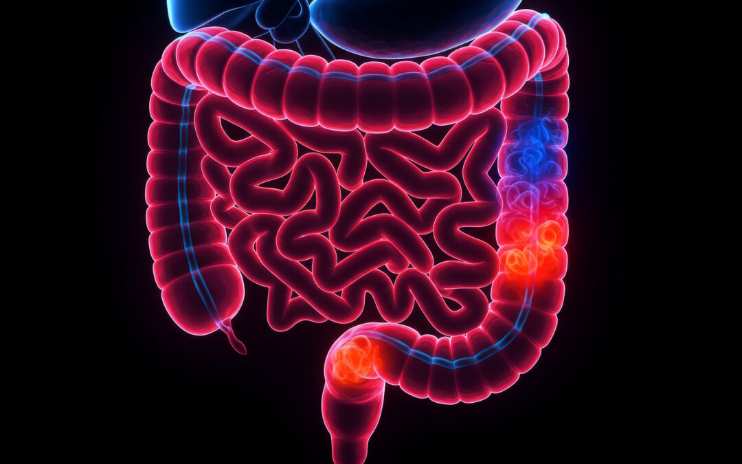 Prof. Dr. Christopher Gerner | Ulcerative Colitis and the Hidden Logic of Chronic Disease