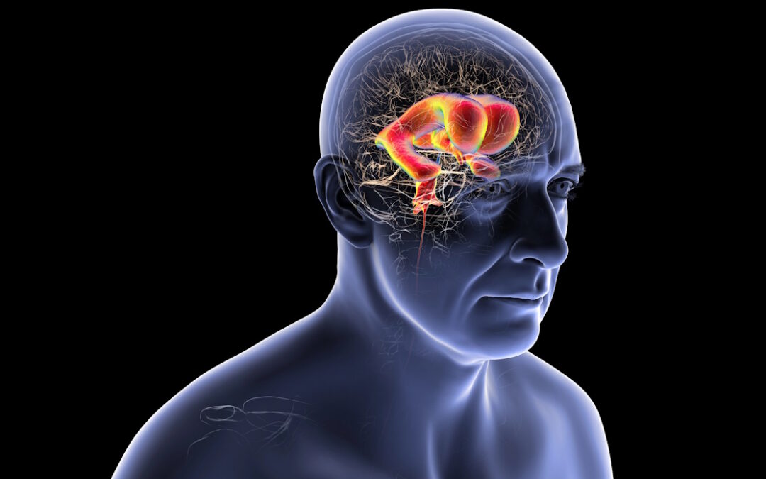 Dr Michael Egnor – Dr Racheed Mani | When the Brain’s Plumbing Is Not the Problem